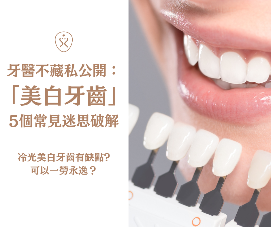 牙醫不藏私公開：美白牙齒5個常見迷思破解，冷光美白牙齒有缺點嗎?可以一勞永逸？（你一定有誤會過）